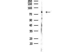 anti-Zinc Finger Protein 420 (ZNF420) (Internal Region) antibody