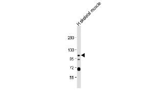 Anti-KCNQ5 Antibody (C-term) at 1:1000 dilution + human skeletal muscle lysate Lysates/proteins at 20 μg per lane. (KCNQ5 anticorps  (C-Term))