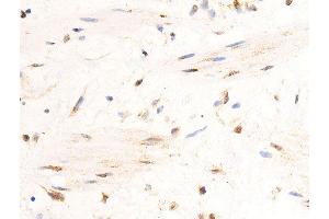 ABIN6276708 at 1/200 staining human heart tissue sections by IHC-P.