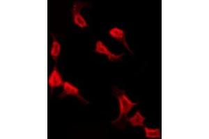 ABIN6277252 staining HepG2 by IF/ICC. (RPS3 anticorps  (Internal Region))