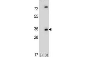 Western blot analysis of Caspase-3 antibody and 293 cell lysate (2 ug/lane) either nontransfected (Lane 1) or transiently transfected (2) with the CASP3 gene.