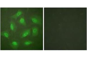 Immunofluorescence analysis of HeLa cells, using JAB1 Antibody. (COPS5 anticorps  (AA 374-423))