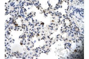 Rabbit Anti-PCYOX1 Antibody       Paraffin Embedded Tissue:  Human alveolar cell   Cellular Data:  Epithelial cells of renal tubule  Antibody Concentration:   4.