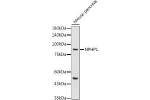 Western blot analysis of extracts of Mouse pancreas, using NPHP1 antibody (ABIN6128349, ABIN6144768, ABIN6144769 and ABIN6222377) at 1:1000 dilution.