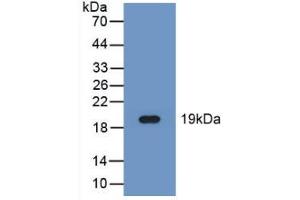 Western blot analysis of recombinant Human FADS2. (FADS2 anticorps  (AA 1-130))