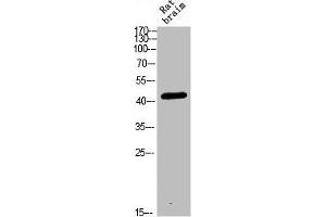 Western blot analysis of RAT-BRAIN Cell Lysate, antibody was diluted at 1:1000. (CRHR2 anticorps  (AA 1268-1341))