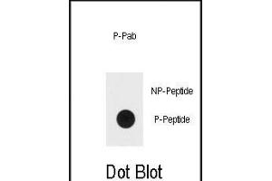 Dot blot analysis of Bi-phospho-ERK1/2-/ Antibody (ABIN389990 and ABIN2839771) on nitrocellulose membrane. (ERK1/2 anticorps  (pThr202, pTyr204))
