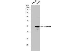 WB Image Various whole cell extracts (30 μg) were separated by 10% SDS-PAGE, and the membrane was blotted with Vimentin antibody , diluted at 1:10000. (Vimentin anticorps)