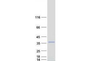 Validation with Western Blot