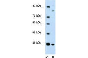 Western Blotting (WB) image for anti-Ankyrin Repeat and Zinc Finger Domain Containing 1 (ANKZF1) antibody (ABIN2461250) (ANKZF1 anticorps)