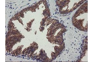 Image no. 5 for anti-Prefoldin Subunit 3 (PFDN3) antibody (ABIN1501705)