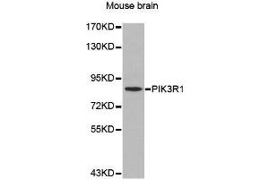 Western Blotting (WB) image for anti-Phosphoinositide 3 Kinase, p85 alpha (PI3K p85a) (AA 1-300) antibody (ABIN3020625) (PIK3R1 anticorps  (AA 1-300))