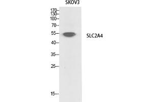 Western Blot analysis of SKOV3 cells using Glut4 Polyclonal Antibody. (GLUT4 anticorps  (N-Term))