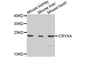 Western blot analysis of extracts of various cell lines, using CRYAA antibody. (CRYAA anticorps  (AA 1-173))