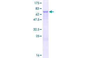 Image no. 1 for Heat Shock Protein 70kDa Family, Member 13 (HSPA13) (AA 1-471) protein (GST tag) (ABIN1307188)