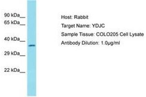 Image no. 1 for anti-YdjC Homolog (YdjC) (AA 217-266) antibody (ABIN6750767)