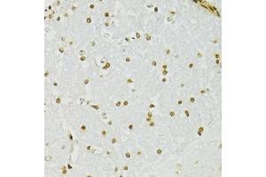 Immunohistochemistry of paraffin-embedded mouse brain using ADAR antibody (ABIN5975213) at dilution of 1/100 (40x lens). (ADAR anticorps)