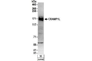 anti-Crm, Cramped-Like (CRAMP1L) (AA 1204-1254) antibody