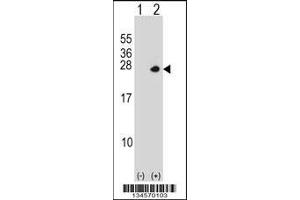 Western blot analysis of PSMD10 using rabbit polyclonal PSMD10 Antibody using 293 cell lysates (2 ug/lane) either nontransfected (Lane 1) or transiently transfected (Lane 2) with the PSMD10 gene.