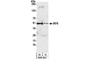 anti-Interferon Regulatory Factor 8 (IRF8) (AA 374-424) antibody