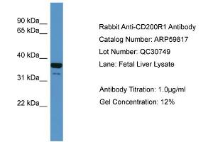 WB Suggested Anti-CD200R1  Antibody Titration: 0.