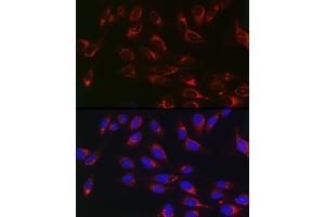 Immunofluorescence analysis of U2OS cells using PSAP Rabbit pAb (ABIN3022605, ABIN3022606, ABIN3022607, ABIN1513432 and ABIN6218938) at dilution of 1:100 (40x lens).