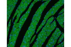 IF analysis of CPT1B using anti-CPT1B antibody (ABIN3042757). (CPT1B anticorps  (N-Term))
