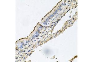 Immunohistochemistry of paraffin-embedded human trachea using DSG1 antibody.