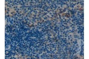 Detection of OC in Mouse Spleen Tissue using Polyclonal Antibody to Osteocalcin (OC)