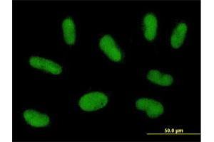 Immunofluorescence of purified MaxPab antibody to PRAM1 on HepG2 cell.