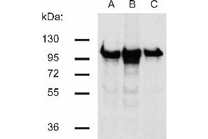 Western blotting analysis of beta-catenin in murine 3T3 (A), C57 (B) and KW1 (C) cell lines using antibody.