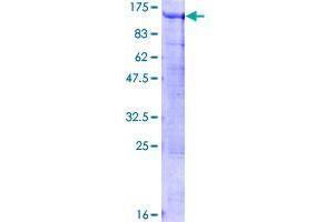 Image no. 1 for Breast Carcinoma Amplified Sequence 3 (BCAS3) (AA 1-913) protein (GST tag) (ABIN1346511)
