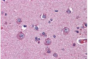 Human Brain, Cortex: Formalin-Fixed, Paraffin-Embedded (FFPE)