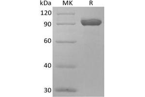 Western Blotting (WB) image for Atrial Natriuretic Peptide Receptor 3 (NPR3) protein (Fc Tag) (ABIN7319905)