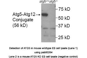 Image no. 1 for anti-ATG5 Autophagy Related 5 (ATG5) (AA 1-50), (N-Term) antibody (ABIN363573) (ATG5 anticorps  (N-Term))