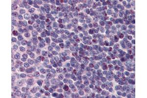 Anti-PCBP1 Antibody IHC staining of human spleen.