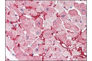 Image no. 3 for anti-Glutamic-Oxaloacetic Transaminase 1, Soluble (Aspartate Aminotransferase 1) (GOT1) (Internal Region) antibody (ABIN372773) (GOT1 anticorps  (Internal Region))