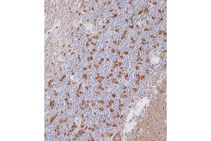 Immunohistochemical analysis of A on paraffin-embedded Human cerebellum tissue. (PAK7 anticorps  (AA 168-198))