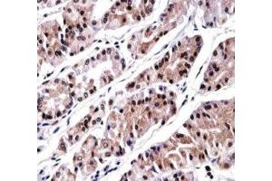 RUNX3 antibody immunohistochemistry analysis in formalin fixed and paraffin embedded human stomach tissue.