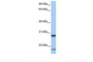 Image no. 1 for anti-Brain-Derived Neurotrophic Factor (BDNF) (AA 146-195) antibody (ABIN6738014) (BDNF anticorps  (AA 146-195))