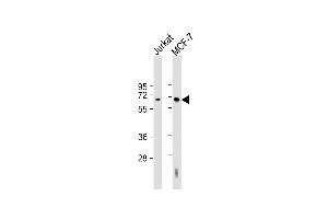 All lanes : Anti-HEXB Antibody (Center) at 1:2000 dilution Lane 1: Jurkat whole cell lysate Lane 2: MCF-7 whole cell lysate Lysates/proteins at 20 μg per lane. (HEXB anticorps  (AA 170-203))