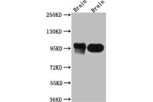Western Blot Positive WB detected in: Rat Brain whole cell lysate, Mouse Brain whole cell lysate All lanes: PSD95 antibody at 1:1000 Secondary Goat polyclonal to rabbit IgG at 1/50000 dilution Predicted band size: 81, 86, 81 kDa Observed band size: 95 kDa (Recombinant DLG4 anticorps)