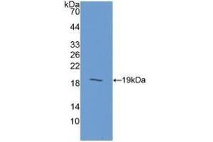 Detection of Recombinant GIP, Human using Polyclonal Antibody to Gastric Inhibitory Polypeptide (GIP) (GIP anticorps  (AA 22-153))