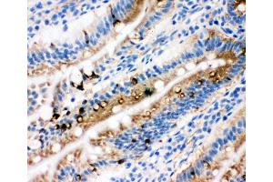 Anti-Egr1 antibody, IHC(F) IHC(F): Rat Intestine Tissue