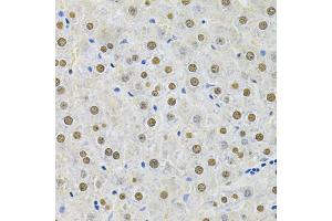 Immunohistochemistry of paraffin-embedded rat liver using SQSTM1 Antibody. (SQSTM1 anticorps)
