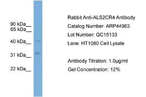 WB Suggested Anti-ALS2CR4  Antibody Titration: 0. (TMEM237 anticorps  (Middle Region))