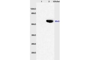 Lane 1: rat liver lysates Lane 2: human colon carcinoma lysates probed with Anti CYP3A4 Polyclonal Antibody, Unconjugated (ABIN733793) at 1:200 in 4 °C.