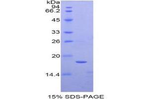 SDS-PAGE analysis of Human TAF13 Protein.
