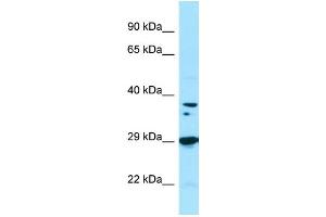 WB Suggested Anti-PPP1CB Antibody Titration: 1. (PPP1CB anticorps  (C-Term))
