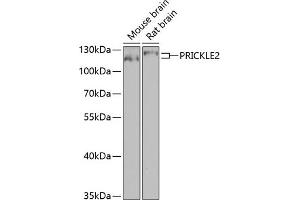 Western blot analysis of extracts of various cell lines, using PRICKLE2 antibody (ABIN6133166, ABIN6146162, ABIN6146163 and ABIN6224046) at 1:1000 dilution. (PRICKLE2 anticorps  (AA 615-844))